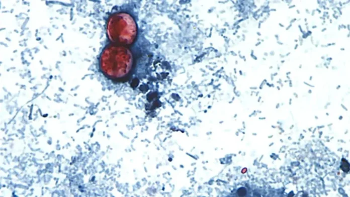 Aumento de casos de parásito Cyclospora.