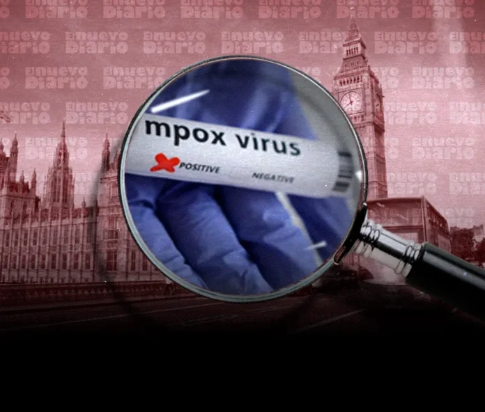 Guinea-Bisáu activa alerta por primer caso de mpox.