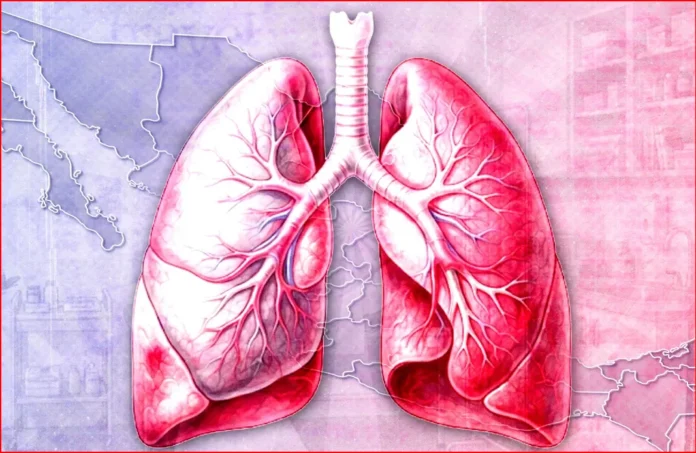 Investigación de tuberculosis en centro de detención