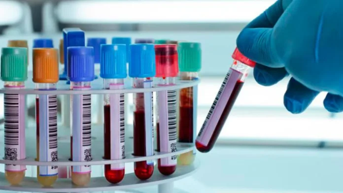 Sangre dorada: el enigma del Rh nulo